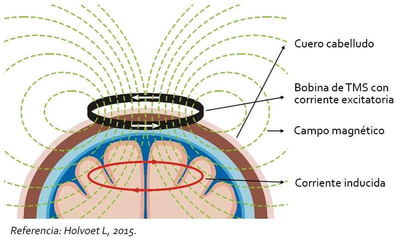 neuromodulación, estimulación, magnética, transcraneal